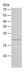    ARL6 / Recombinant Human ARL6