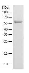    WHSC2 / Recombinant Human WHSC2