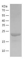    GSTO2 / Recombinant Human GSTO2