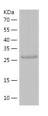    ASB8 / Recombinant Human ASB8