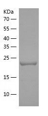    UBE2Z / Recombinant Human UBE2Z