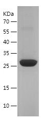    METTL21D / Recombinant Human METTL21D