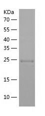    Mob1A / Recombinant Human Mob1A