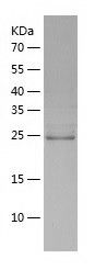    Phafin-2 / Recombinant Human Phafin-2