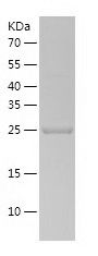    TRFP / Recombinant Human TRFP