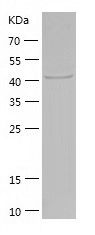    QTRTD1 / Recombinant Human QTRTD1