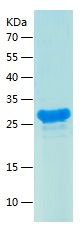    DBNDD1 / Recombinant Human DBNDD1