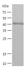    RRAGC / Recombinant Human RRAGC