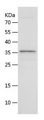    IL-21 / Recombinant Human IL-21