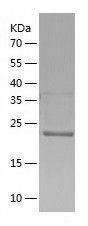    IL-21R / Recombinant Human IL-21R