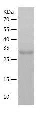    NMRAL1 / Recombinant Human NMRAL1