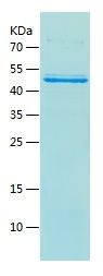    SENP2 / Recombinant Human SENP2