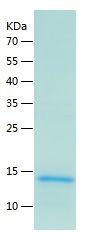    XAGE1 / Recombinant Human XAGE1