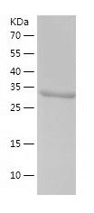 Recombinant Mouse Galectin 8