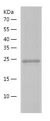    Rab18 / Recombinant Human Rab18