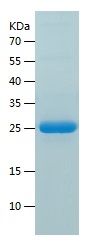    FGF20 / Recombinant Human FGF20