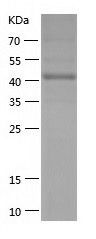    LPAP / Recombinant Human LPAP