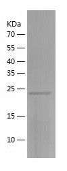    ZC4H2 / Recombinant Human ZC4H2