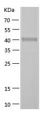    SH3GLB2 / Recombinant Human SH3GLB2