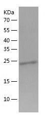    PRTFDC1 / Recombinant Human PRTFDC1