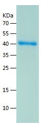    C1GALT1 / Recombinant Human C1GALT1