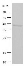    Zhangfei / Recombinant Human Zhangfei