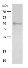    MBIP / Recombinant Human MBIP