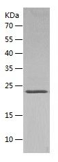    FGF21 / Recombinant Human FGF21