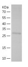    HOMER2 / Recombinant Human HOMER2