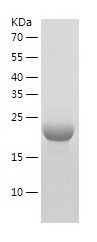    CENPM / Recombinant Human CENPM