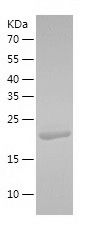    STARD5 / Recombinant Human STARD5