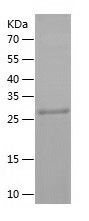    SIRT3 / Recombinant Human SIRT3