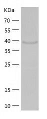    ETNK2 / Recombinant Human ETNK2