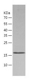    ASF1b / Recombinant Human ASF1b