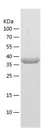    CUEDC1 / Recombinant Human CUEDC1