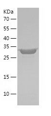    SIRT5 / Recombinant Human SIRT5