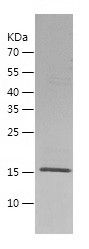    ARL15 / Recombinant Human ARL15