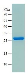    KCTD5 / Recombinant Human KCTD5