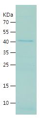    HAO2 / Recombinant Human HAO2