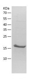    NUDT4 / Recombinant Human NUDT4