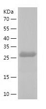    RBJ / Recombinant Human RBJ