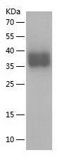    PD-L1 / Recombinant Human PD-L1