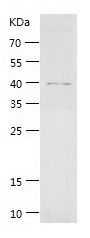    LMCD1 / Recombinant Human LMCD1