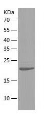    CHMP5 / Recombinant Human CHMP5