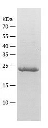    THYN1 / Recombinant Human THYN1