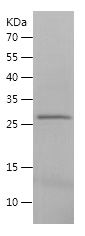    SENP1Catalytic domain / Recombinant Human SENP1Catalytic domain