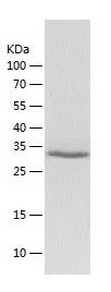    PIM2 / Recombinant Human PIM2