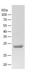 Recombinant Mouse AK 1