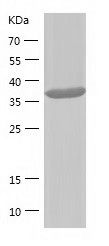    SAE1 / Recombinant Human SAE1