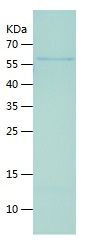    PGC1 alpha / Recombinant Human PGC1 alpha